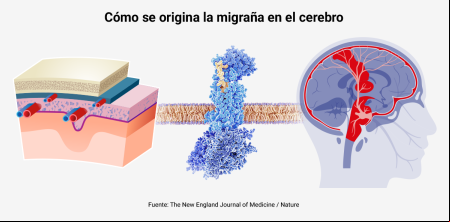 Llegan nuevos fármacos para prevenir los ataques de migraña