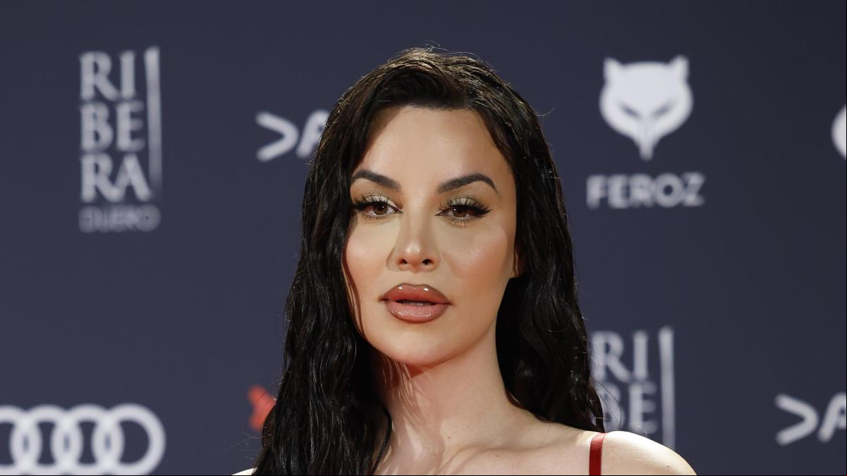 Jadet advierte sobre las consecuencias que sufre tras pincharse la cara: “Yo soy un pillow face”