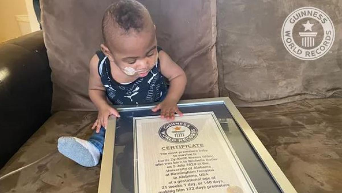 Un niño que nació a las 21 semanas es nombrado el bebé más prematuro del mundo en sobrevivir