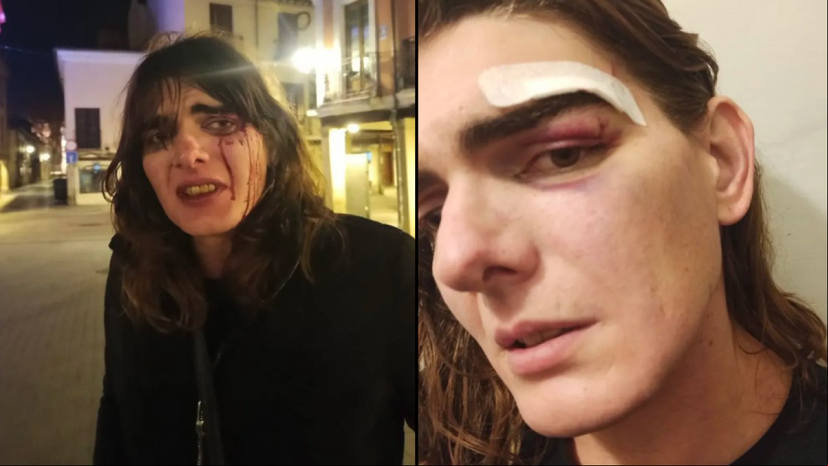 Se crea con IA el rostro de los sospechosos de la agresión tránsfoba con datos de las víctimas
